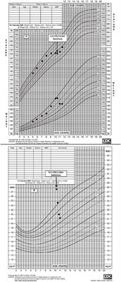 Growth Failure and Excessive Weight Gain in a 10 Year Old Male With Obesity: Approach to Diagnosis, Management, and Treatment of Acquired Hypothyroidism